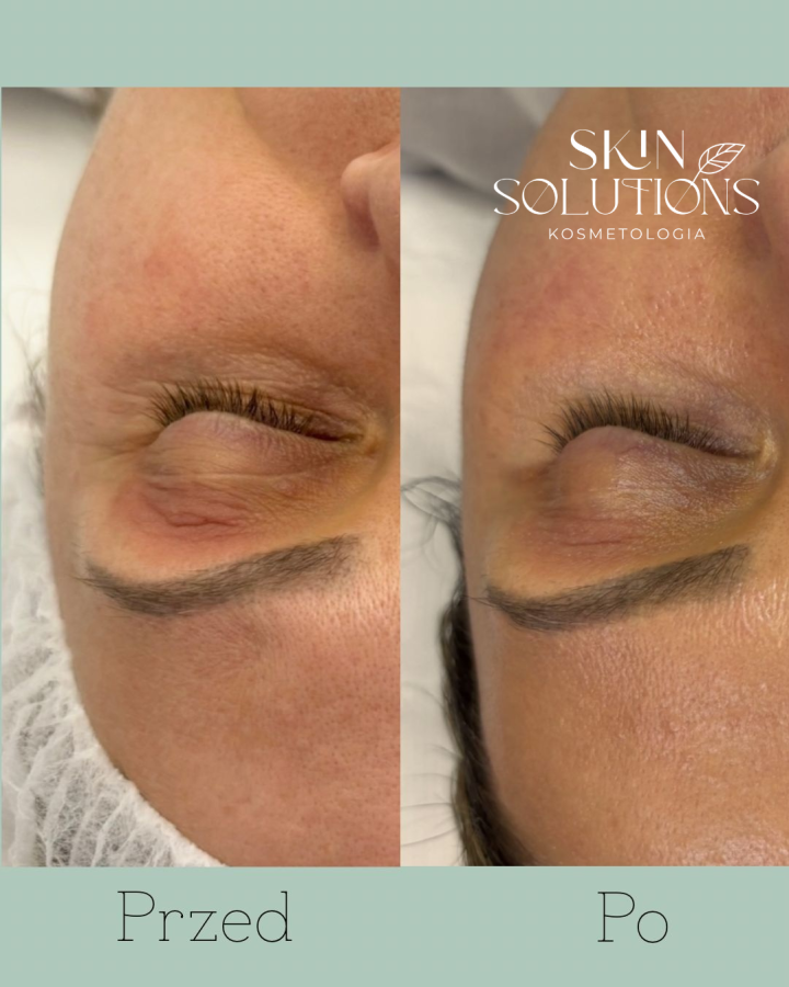 SkinSolutions Wrocław - zdjęcie nr 3